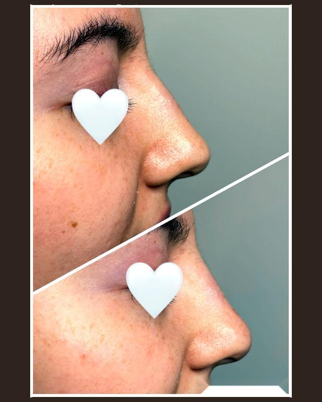 Before and after treatment result