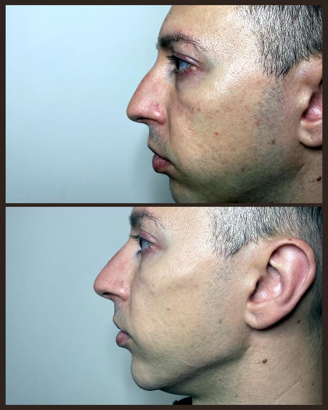 Before and after treatment result