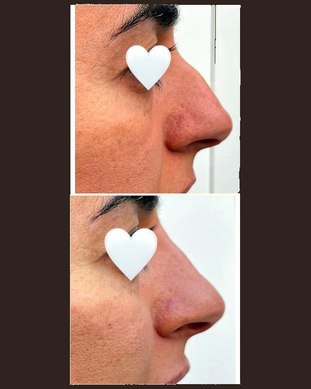 Before and after treatment result