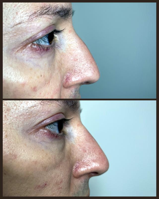 Before and after treatment result