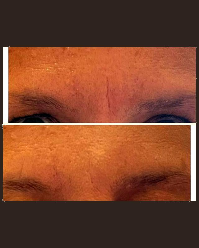 Before and after treatment result