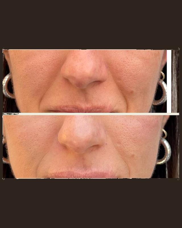 Before and after treatment result