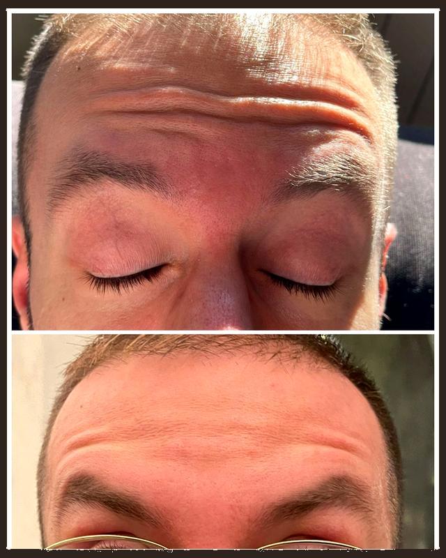 Before and after treatment result