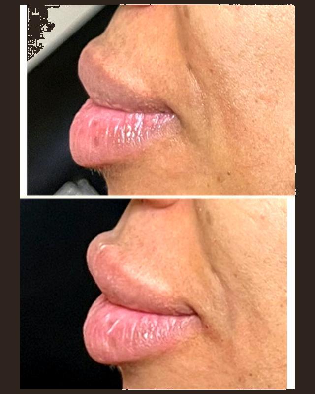 Before and after treatment result